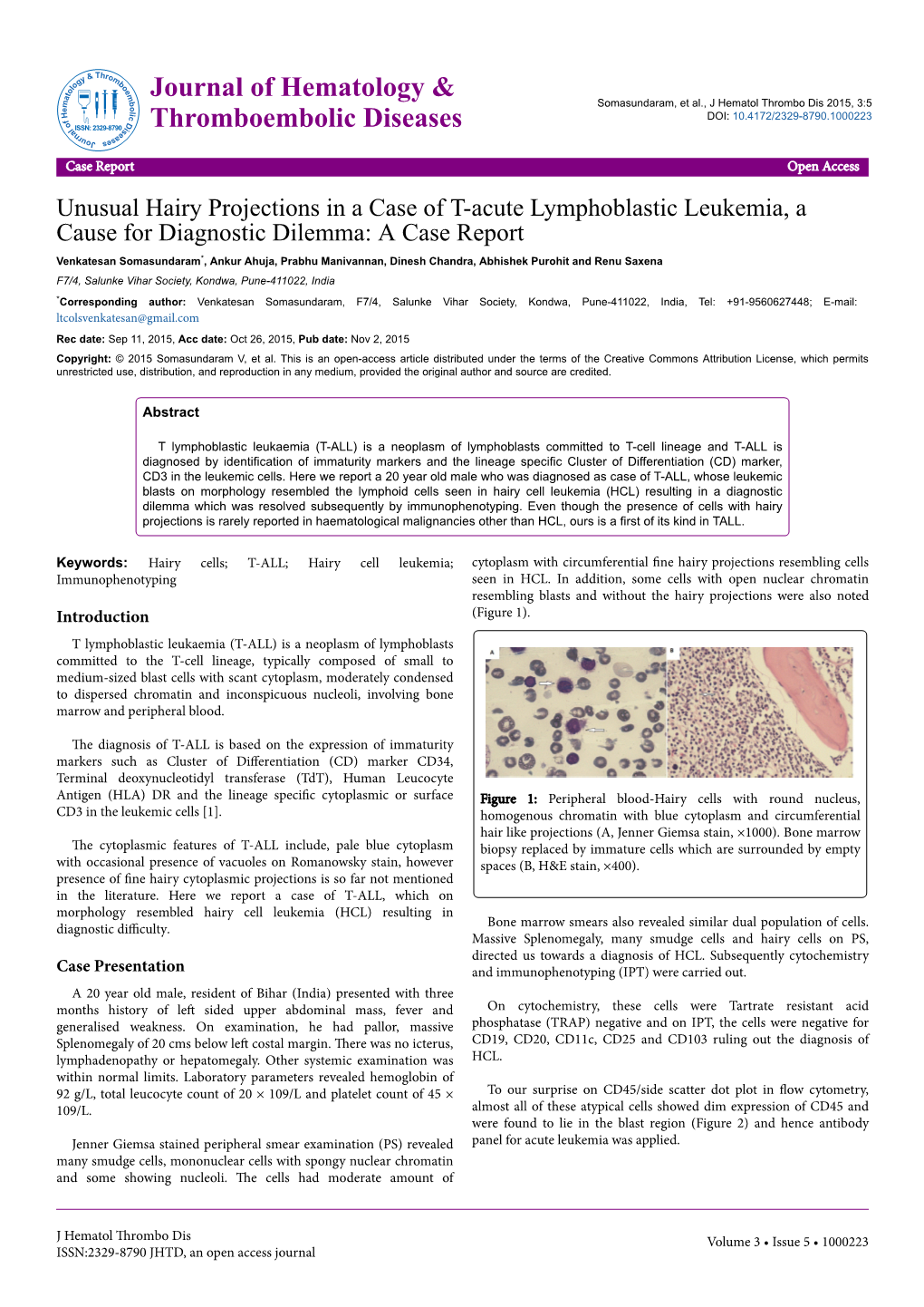 Unusual Hairy Projections in a Case of T-Acute Lymphoblastic Leukemia, a Cause for Diagnostic Dilemma: a Case Report