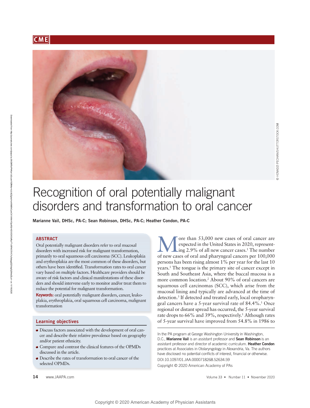 Recognition of Oral Potentially Malignant Disorders and Transformation to Oral Cancer