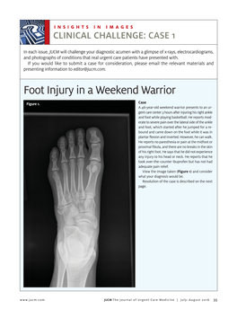 Foot Injury in a Weekend Warrior