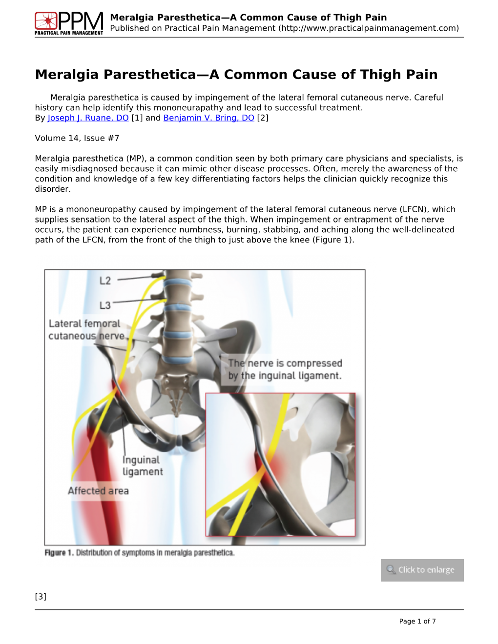 Meralgia Paresthetica—A Common Cause of Thigh Pain Published on Practical Pain Management (