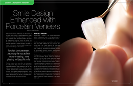 Smile Design Enhanced with Porcelain Veneers by Dean C