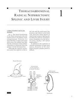 Thoracoabdominal Radical Nephrectomy: 1 Splenic and Liver Injury