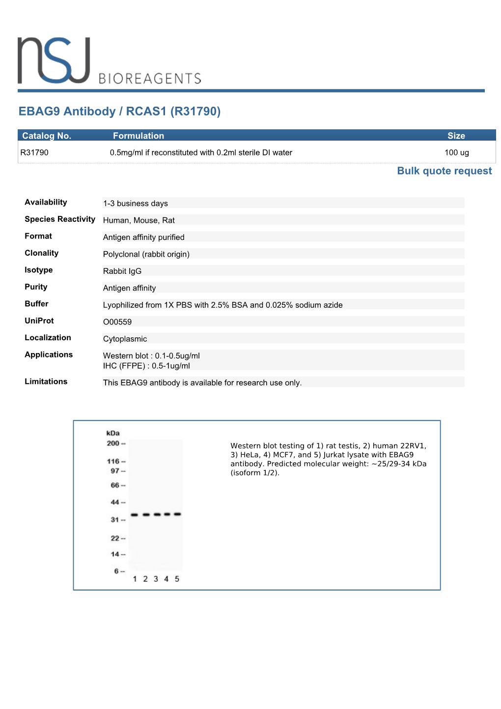 EBAG9 Antibody / RCAS1 (R31790)