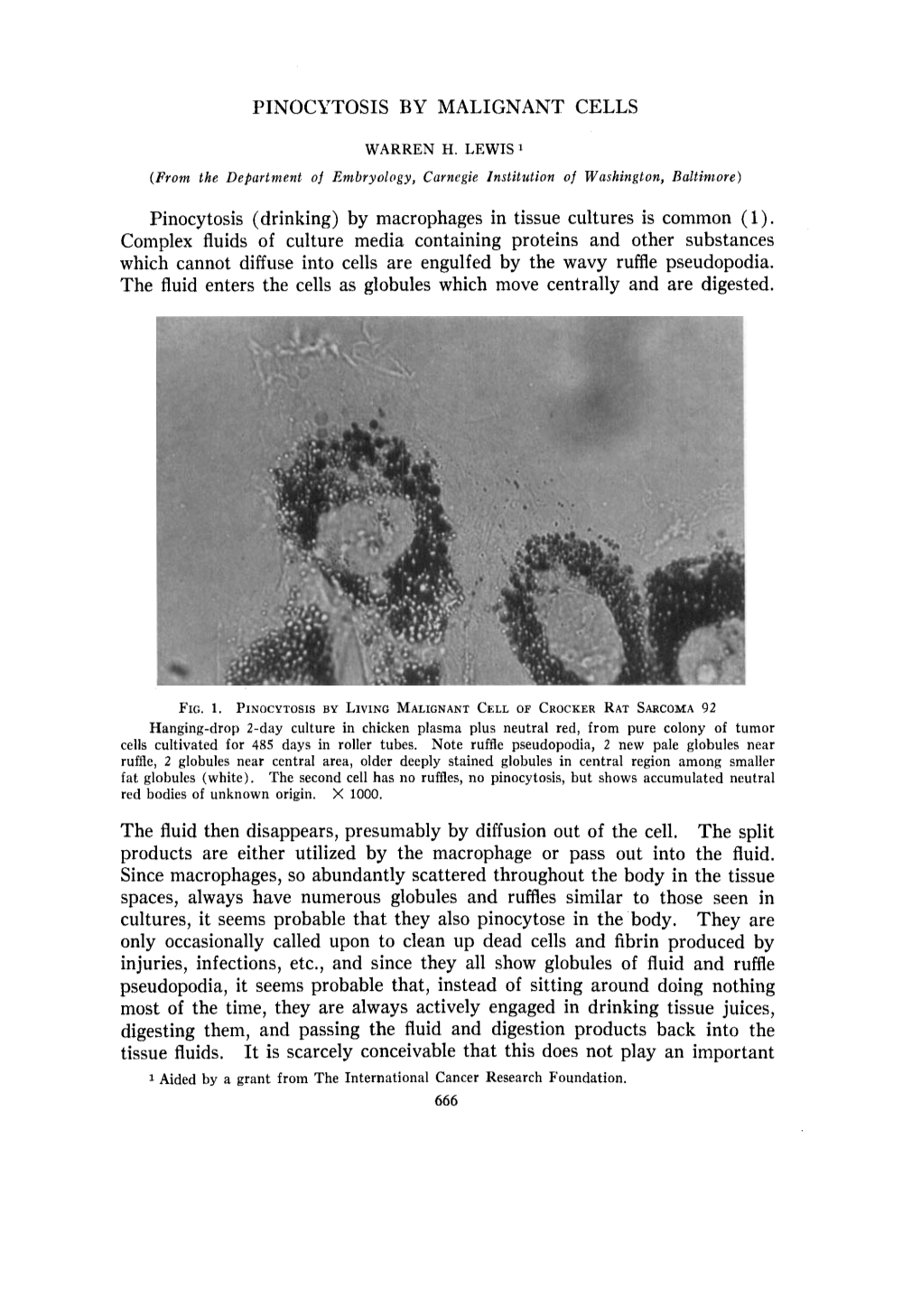 PINOCYTOSIS by MALIGNANT CELLS Pinocytosis (Drinking) by Macrophages in Tissue Cultures Is Common (1). Complex Fluids of Culture