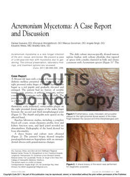 Acremonium Mycetoma: a Case Report and Discussion