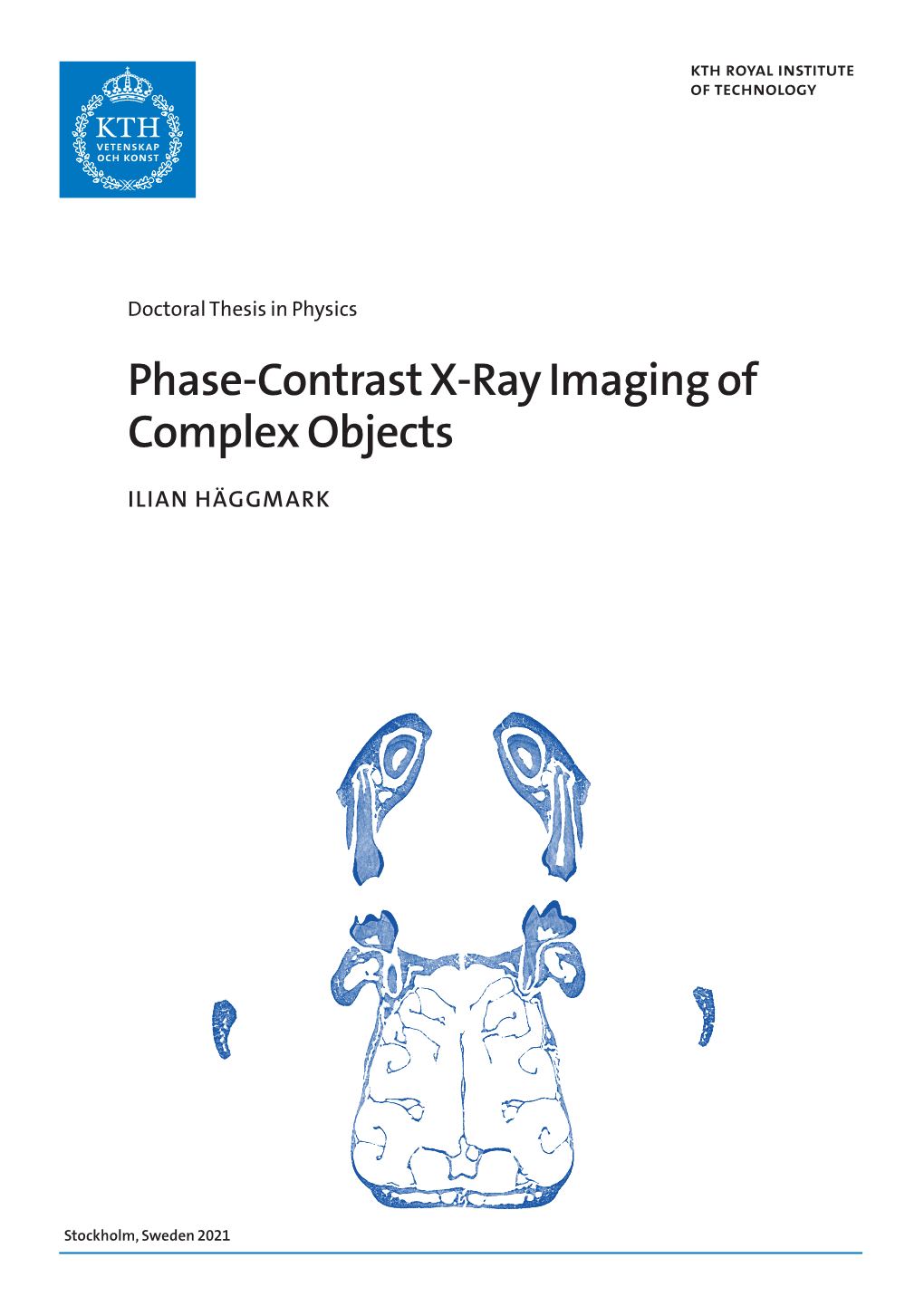 Phase-Contrast X-Ray Imaging of Complex Objects