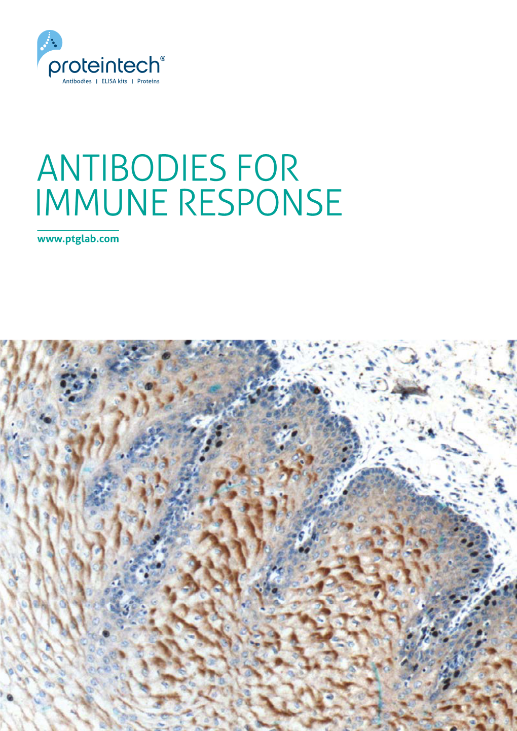 IMMUNE RESPONSE 2 Antibodies for Immune Response