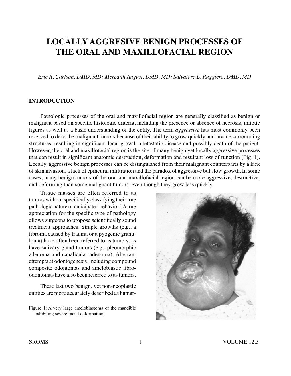 Locally Aggresive Benign Processes of the Oral and Maxillofacial Region