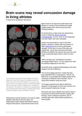 Brain Scans May Reveal Concussion Damage in Living Athletes 10 April 2019, by Marilynn Marchione