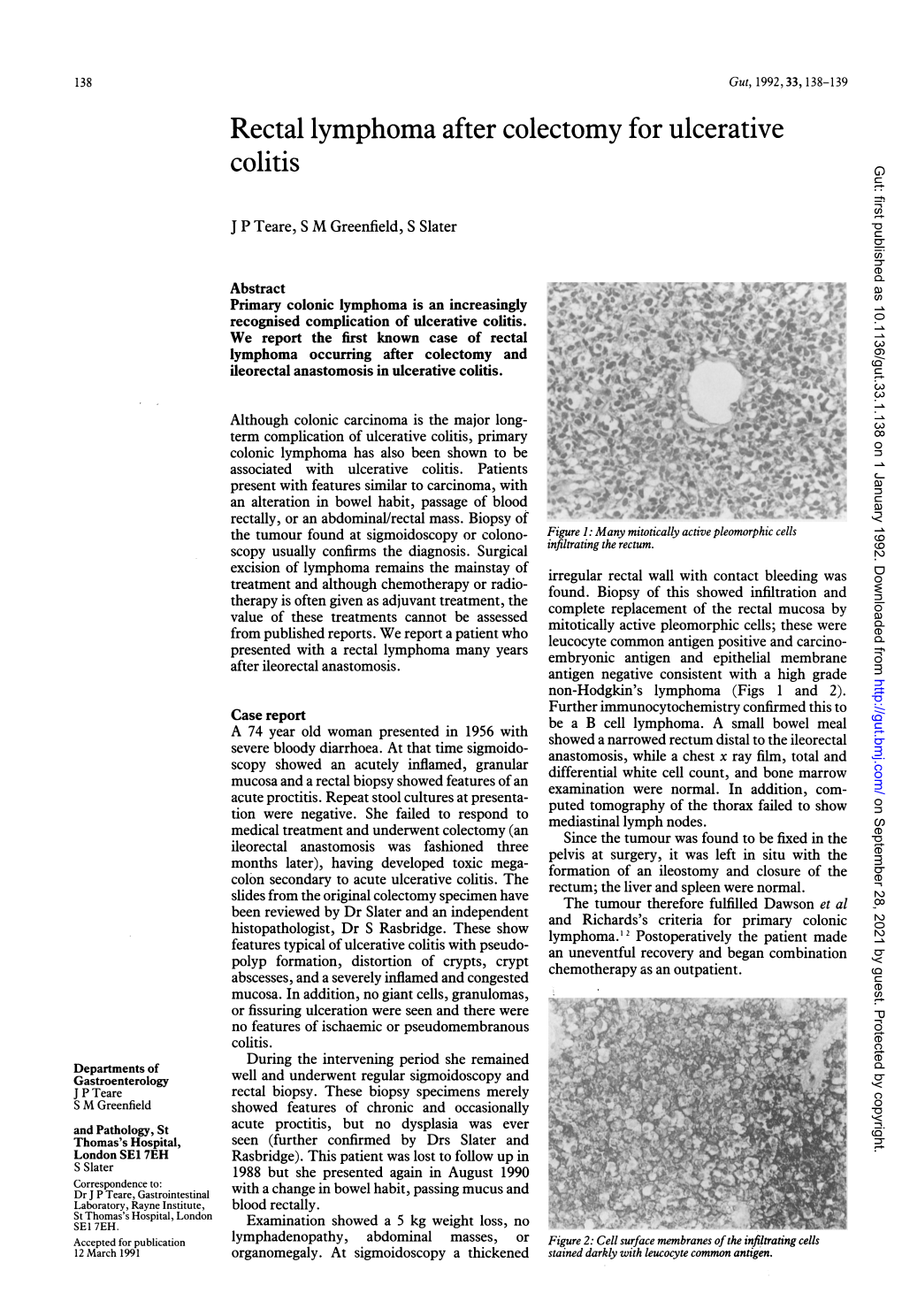 Rectal Lymphoma After Colectomy for Ulcerative