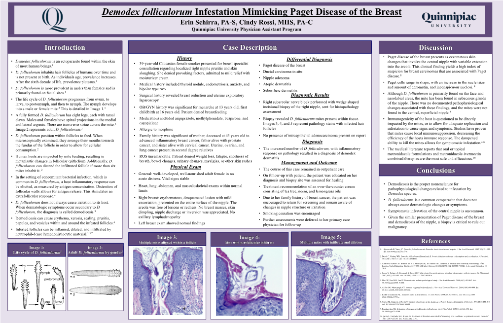 Demodex Folliculorum Infestation Mimicking Paget Disease of the Breast Erin Schirra, PA-S, Cindy Rossi, MHS, PA-C Quinnipiac University Physician Assistant Program