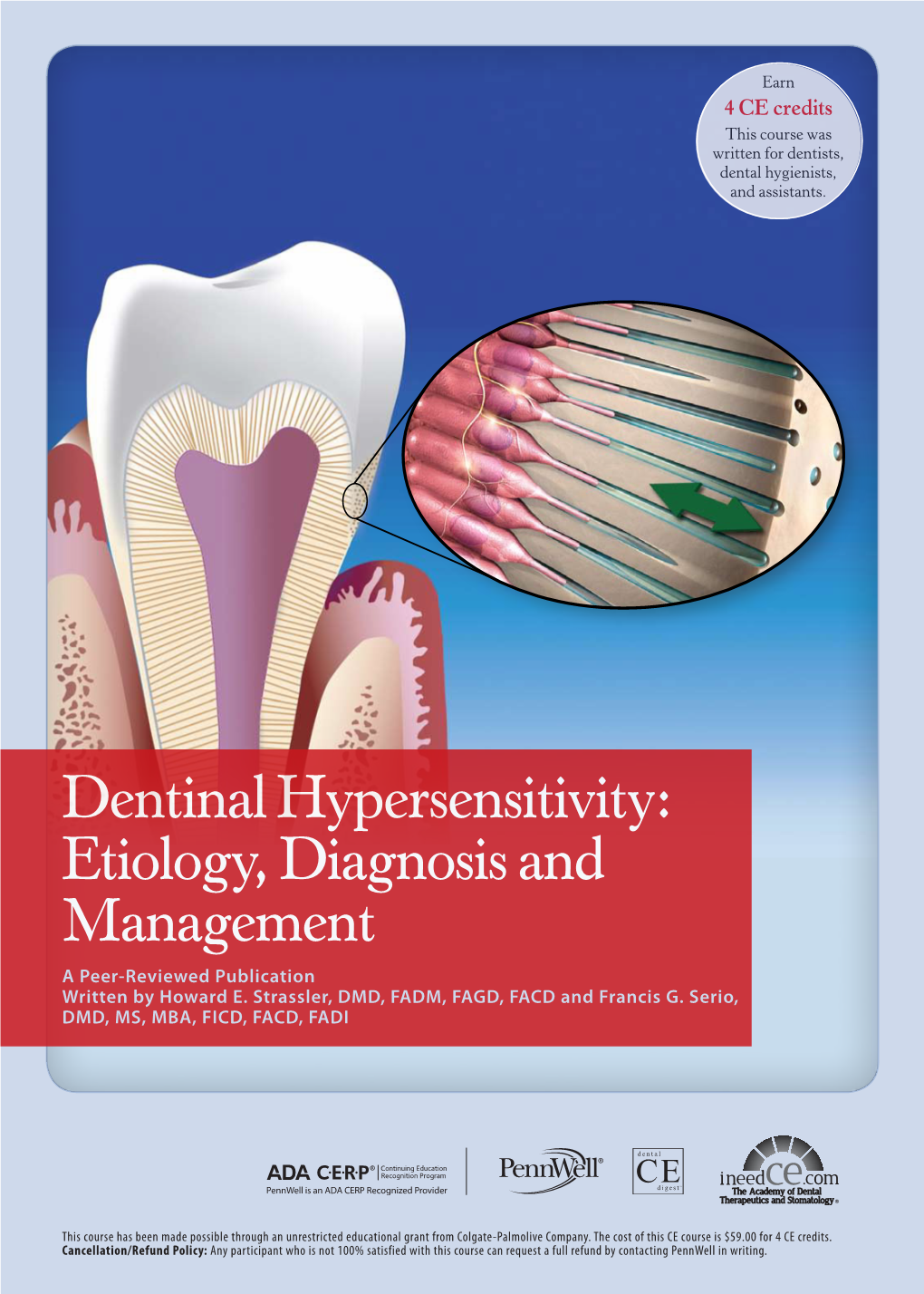 Dentinal Hypersensitivity: Etiology, Diagnosis and Management a Peer-Reviewed Publication Written by Howard E