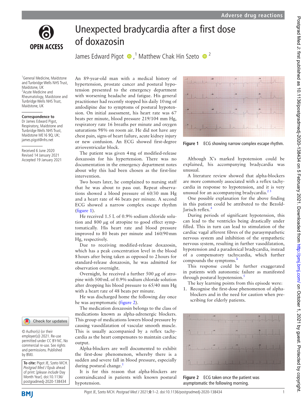 Unexpected Bradycardia After a First Dose of Doxazosin James Edward Pigot ‍ ‍ ,1 Matthew Chak Hin Szeto ‍ ‍ 2