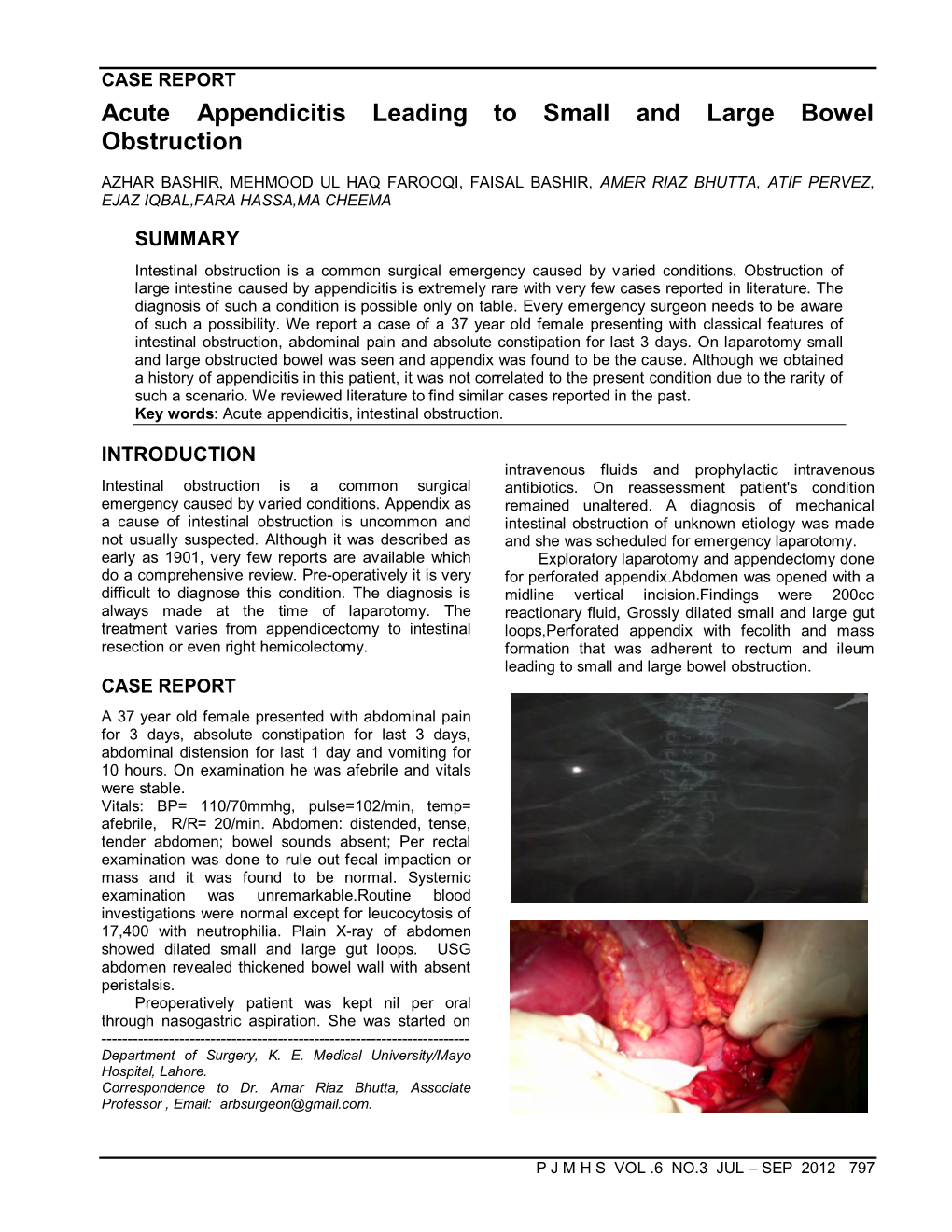 Acute Appendicitis Leading to Small and Large Bowel Obstruction