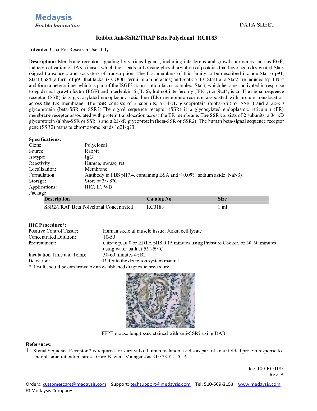 SSR2/TRAP Beta Polyclonal: RC0183