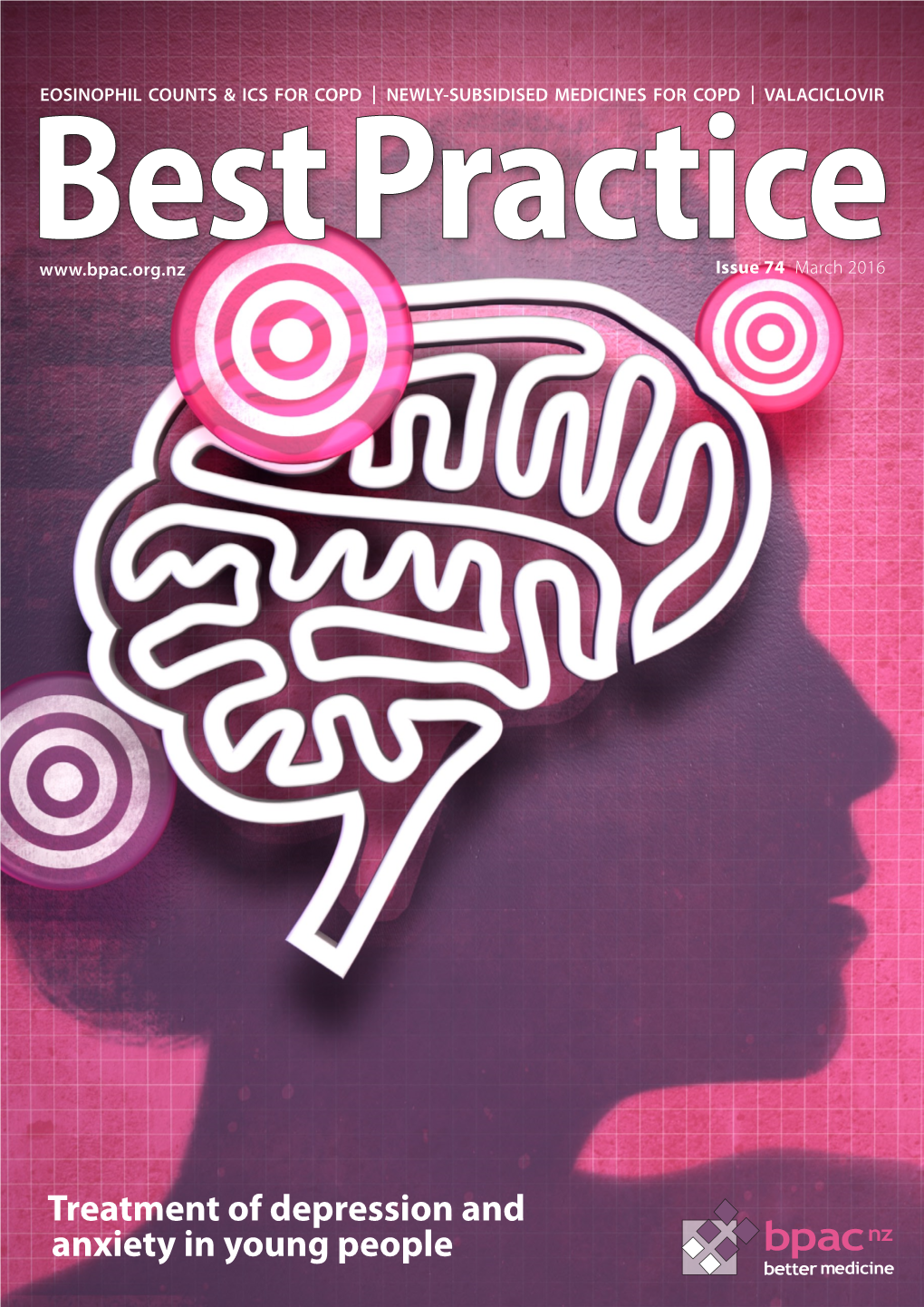 Treatment of Depression and Anxiety in Young People Bpac Nz Better Medicine EDITOR-IN-CHIEF Professor Murray Tilyard