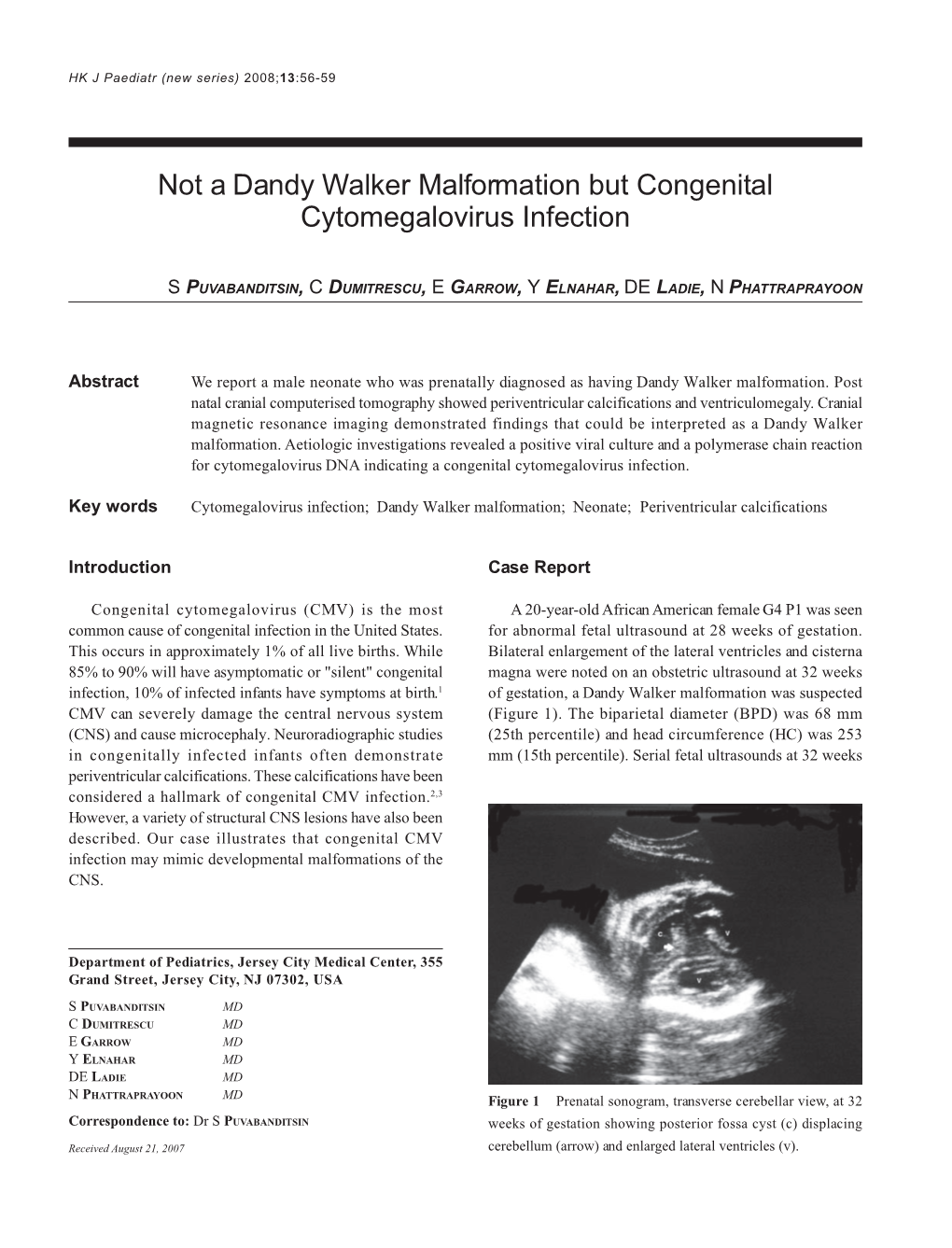 Not a Dandy Walker Malformation but Congenital Cytomegalovirus Infection