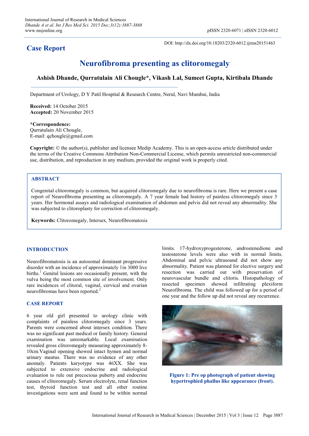 Neurofibroma Presenting As Clitoromegaly