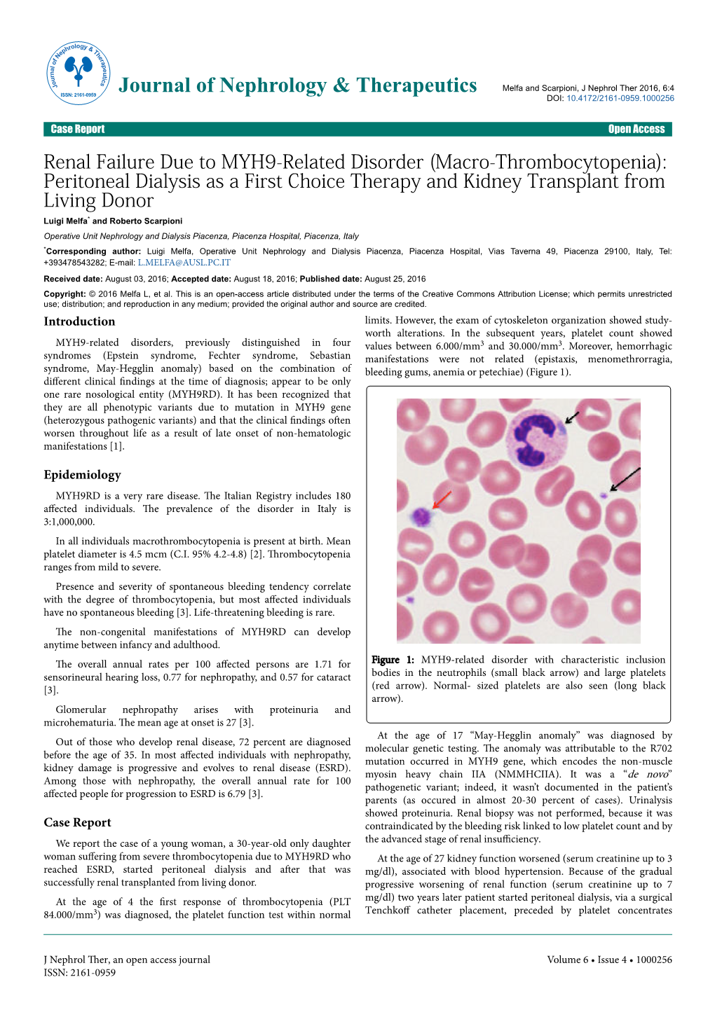 (Macro-Thrombocytopenia): Peritoneal