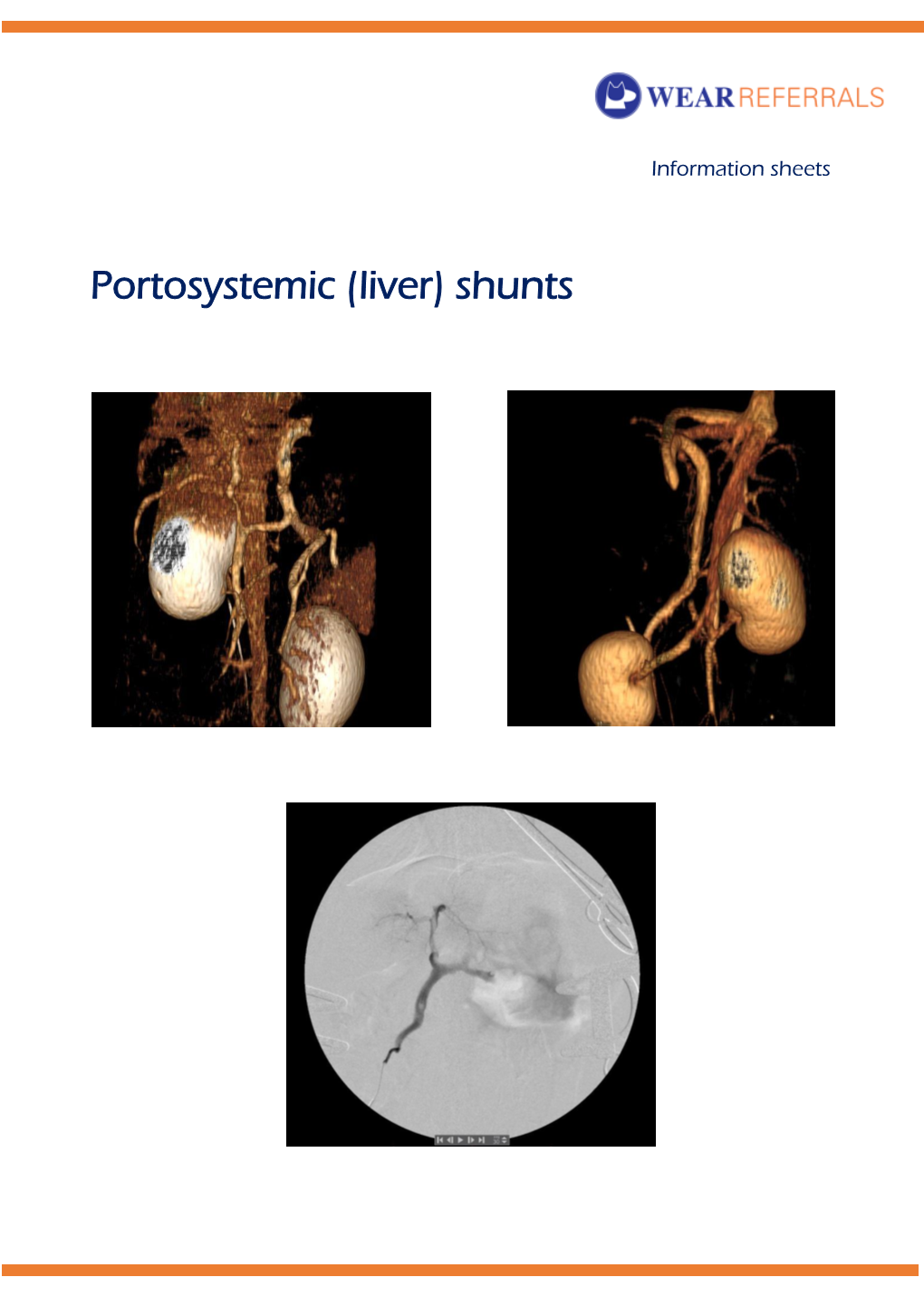 Portosystemic (Liver) Shunts