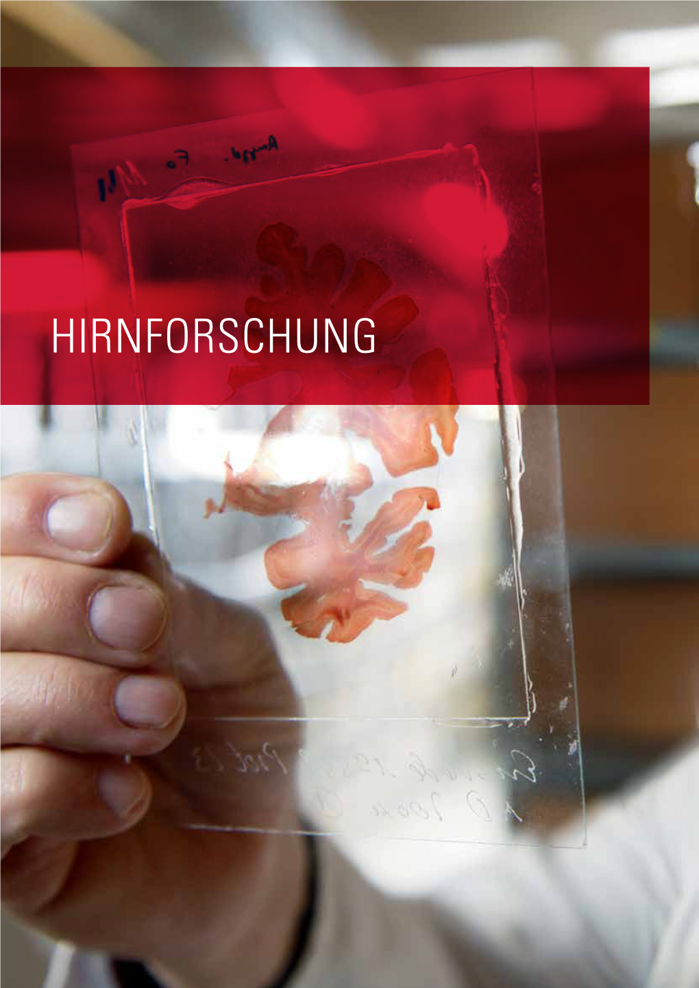 Hirnforschung Hirnforschung