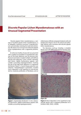 Discrete Papular Lichen Myxedematosus with an Unusual Segmental Presentation