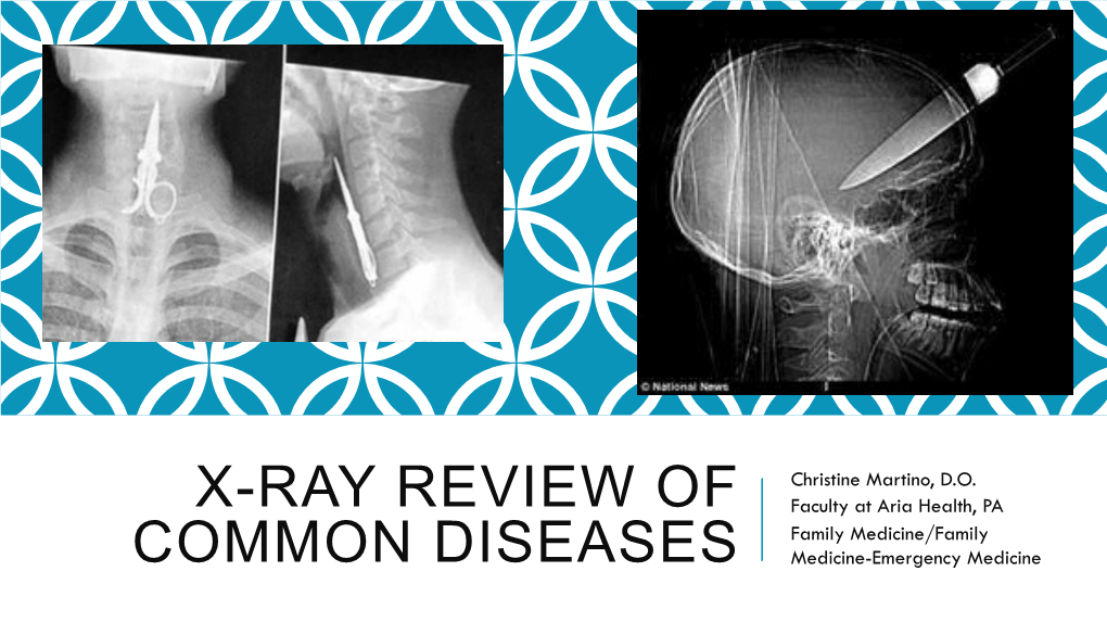 X-Ray Review of Common Diseases
