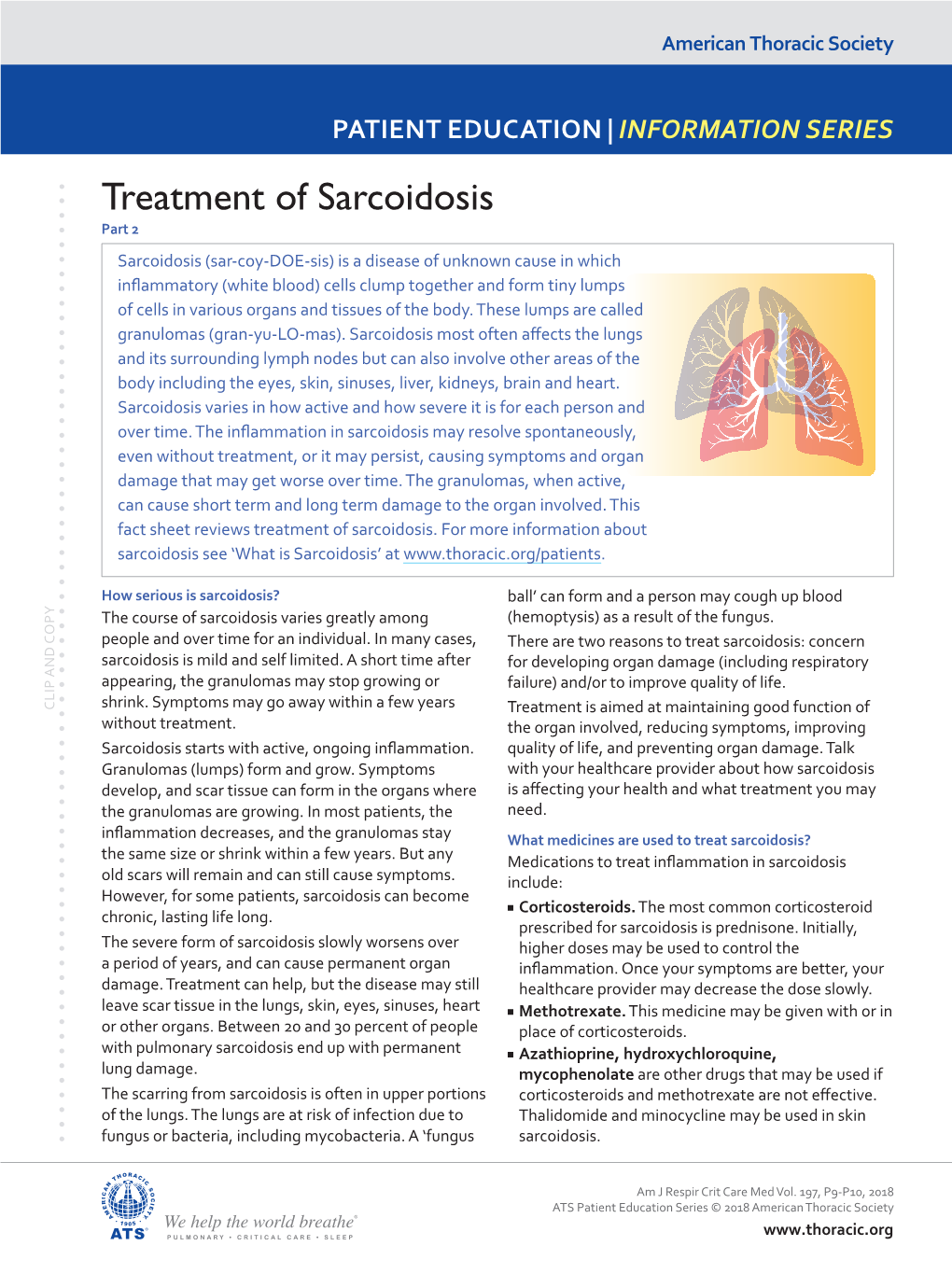 Treatment of Sarcoidosis