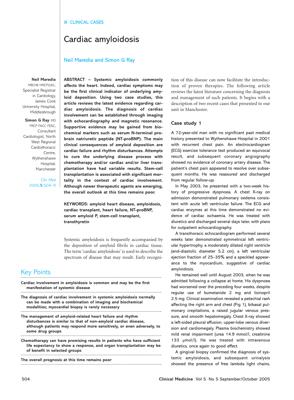 Cardiac Amyloidosis