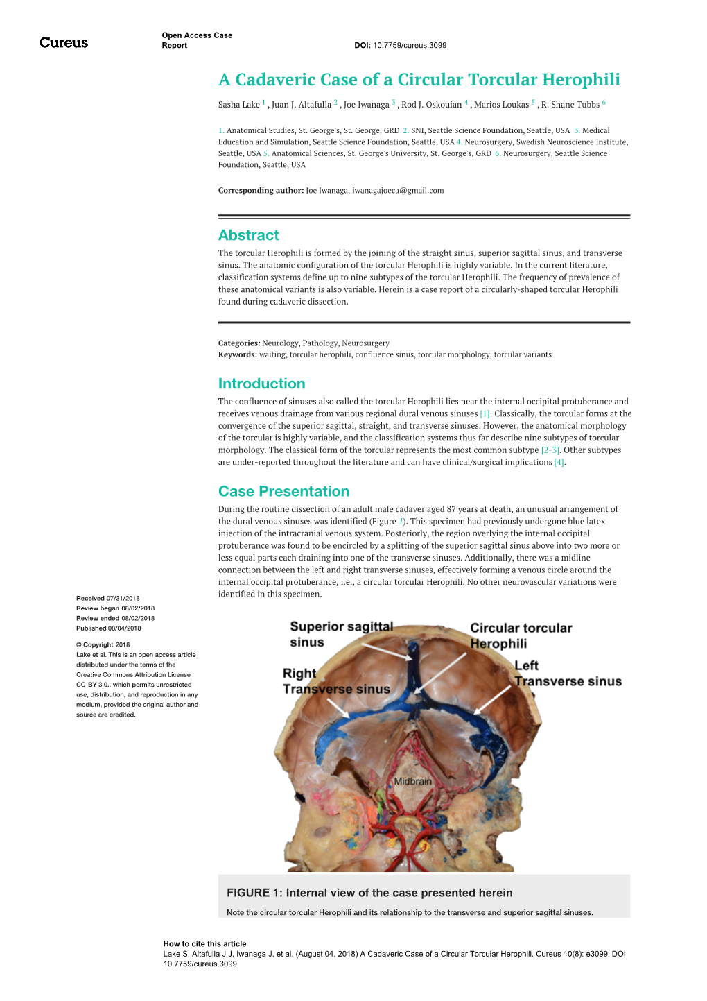 A Cadaveric Case of a Circular Torcular Herophili