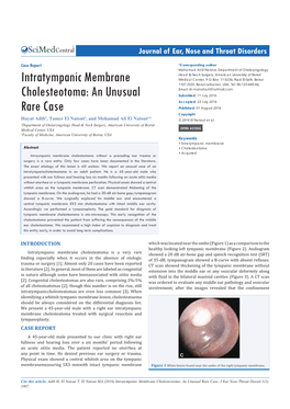 Intratympanic Membrane Cholesteotoma: an Unusual Rare Case