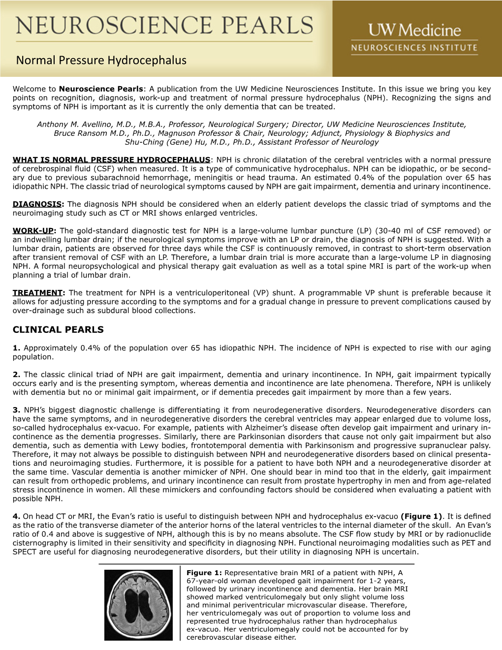 Normal Pressure Hydrocephalus