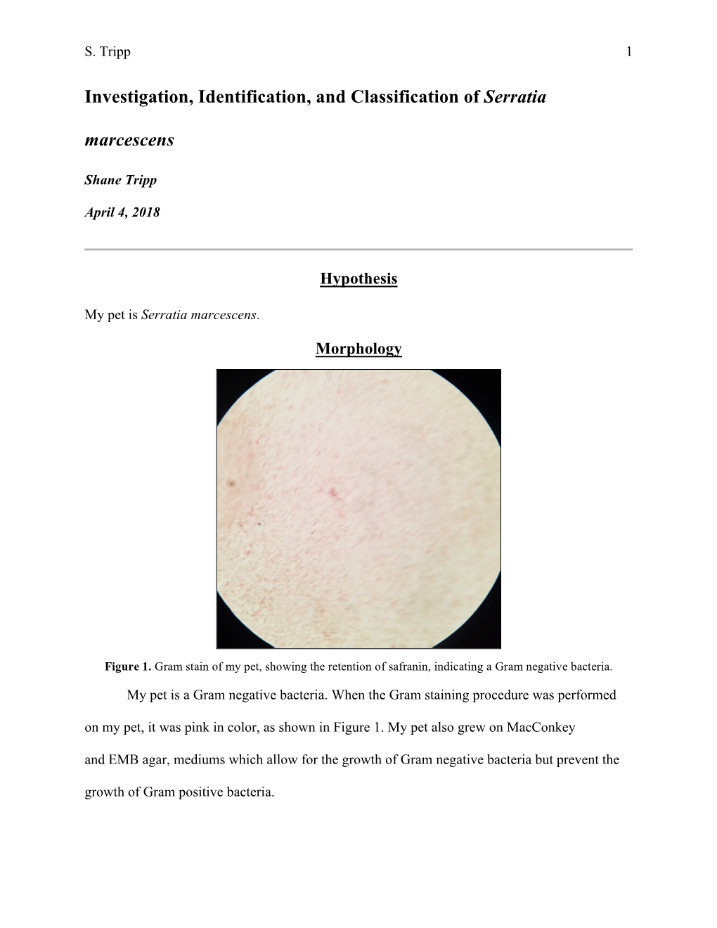 Investigation, Identification, and Classification of Serratia Marcescens