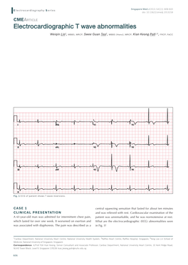 Electrocardiographic T Wave Abnormalities