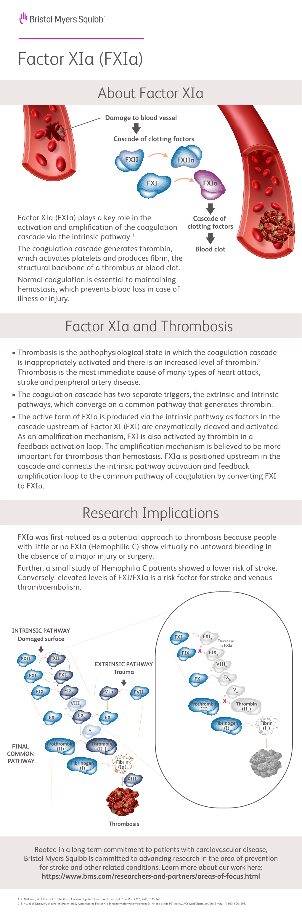 Factor Xia Factsheet