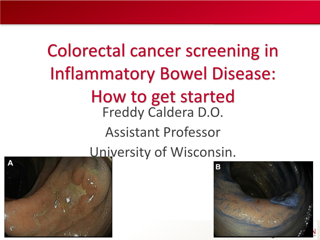 Atlas of Endoscopic Pictures of Chromoendoscopy and How to Get