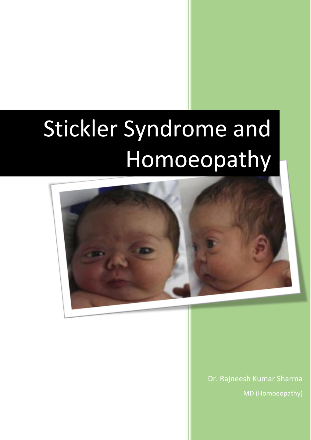 Stickler Syndrome and Homoeopathy