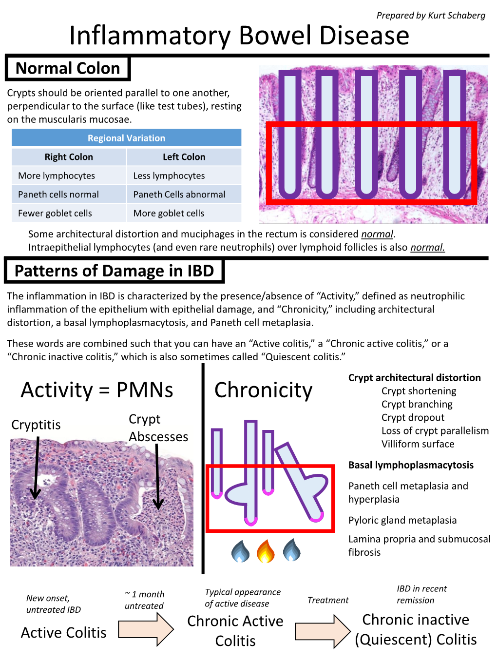 Inflammatory Bowel Disease