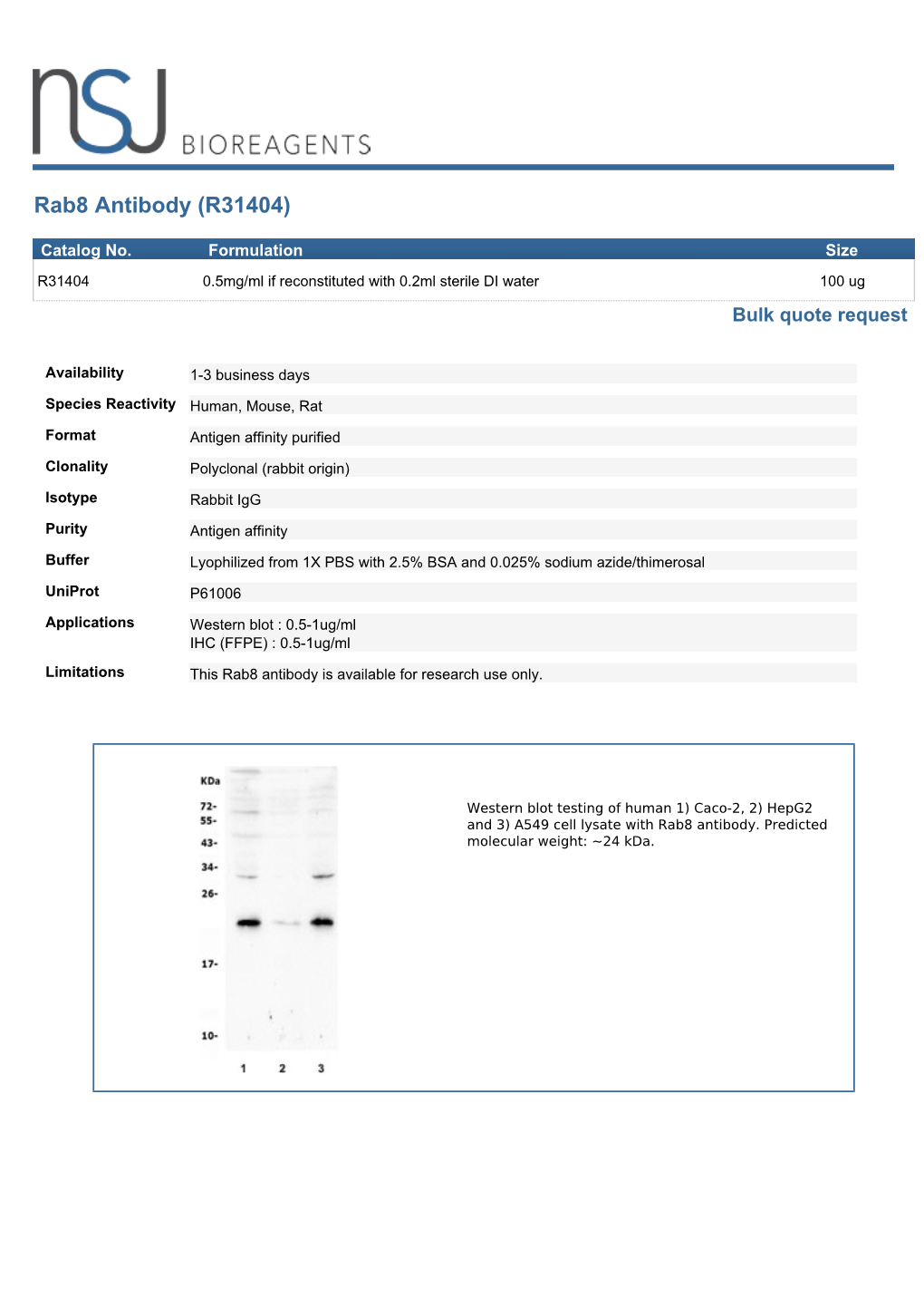 Rab8 Antibody (R31404)