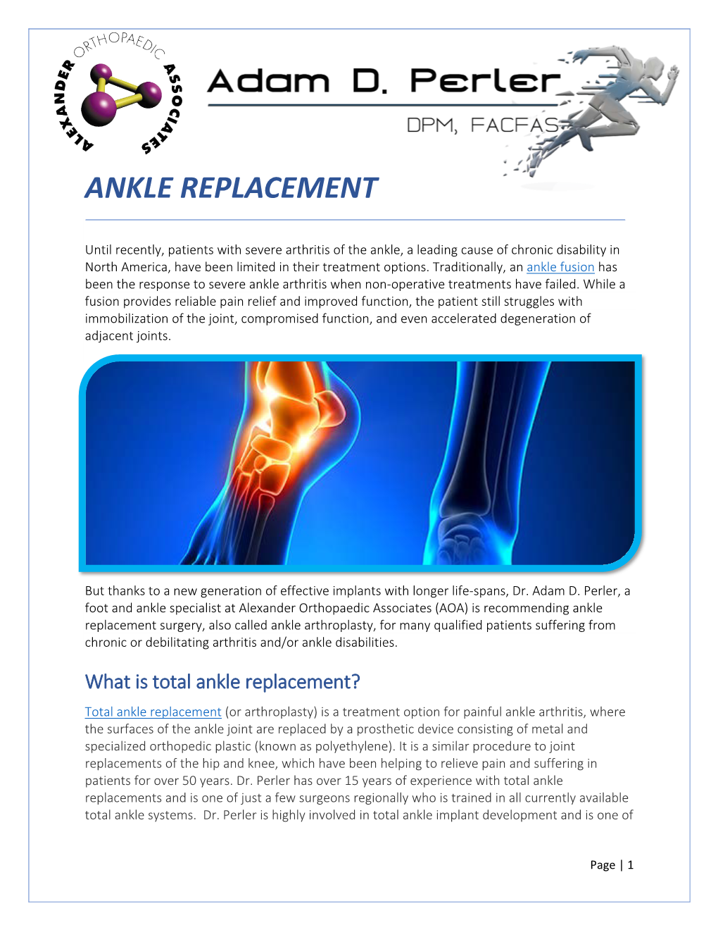 Ankle Replacement