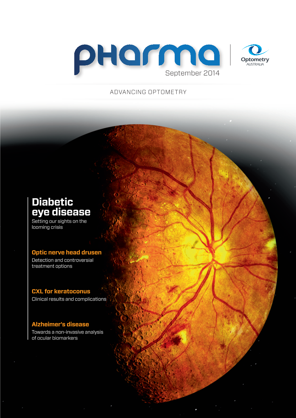 Diabetic Eye Disease Setting Our Sights on the Looming Crisis