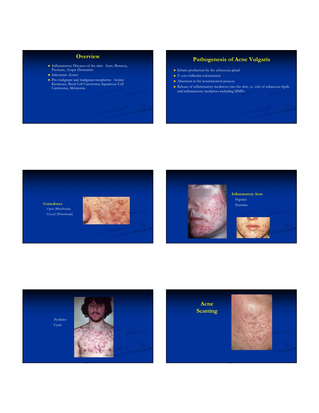 overview-pathogenesis-of-acne-vulgaris-acne-scarring-docslib