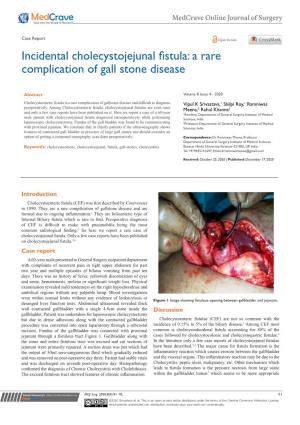 Incidental Cholecystojejunal Fistula: a Rare Complication of Gall Stone Disease