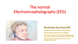 The Normal Electroencephalography (EEG)