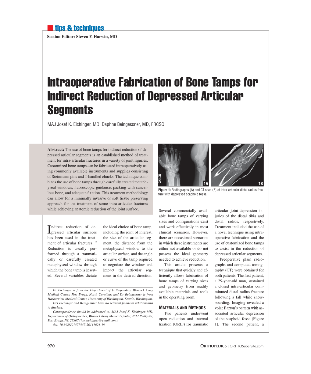 Intraoperative Fabrication of Bone Tamps for Indirect Reduction of Depressed Articular Segments
