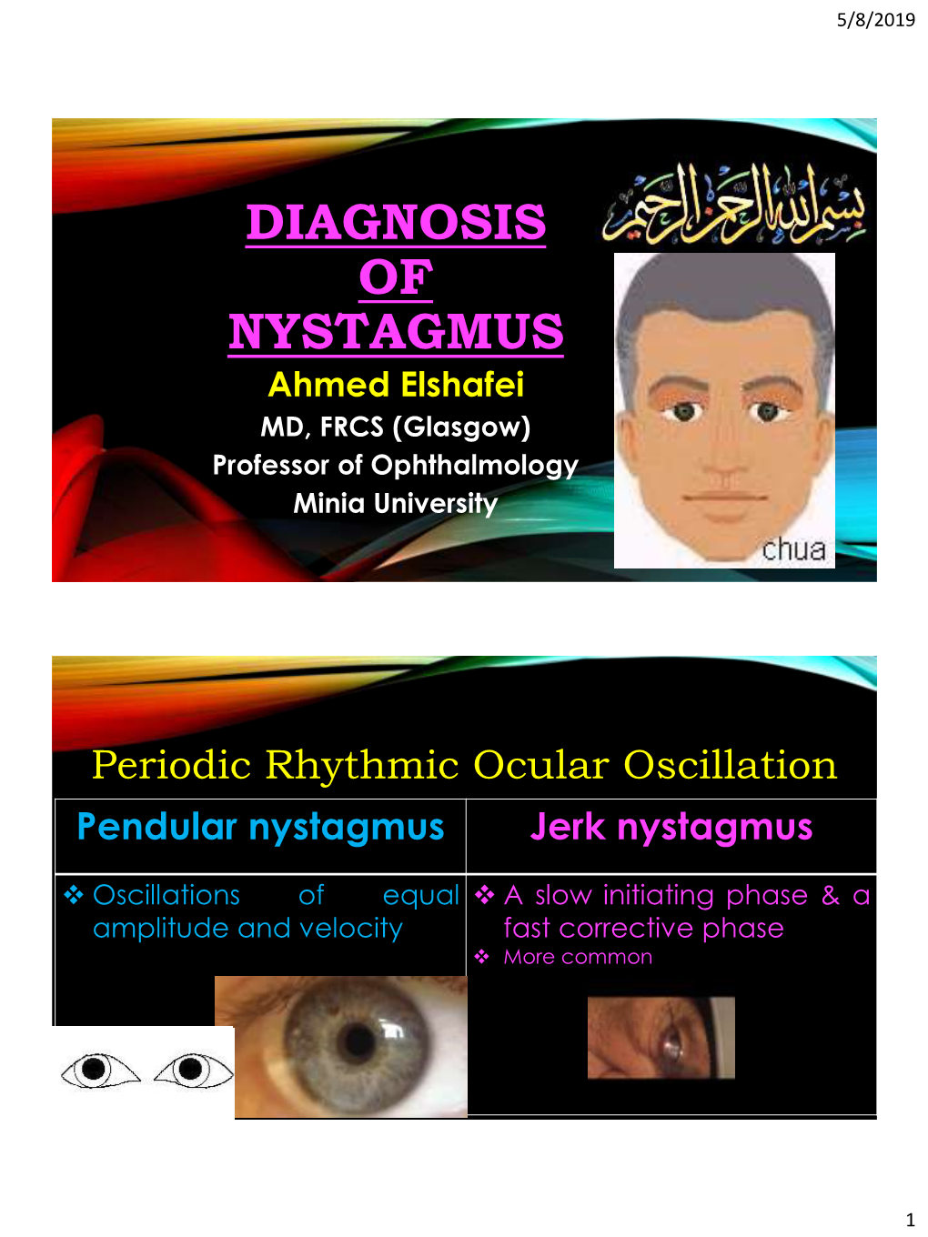 Latent Nystagmus 7