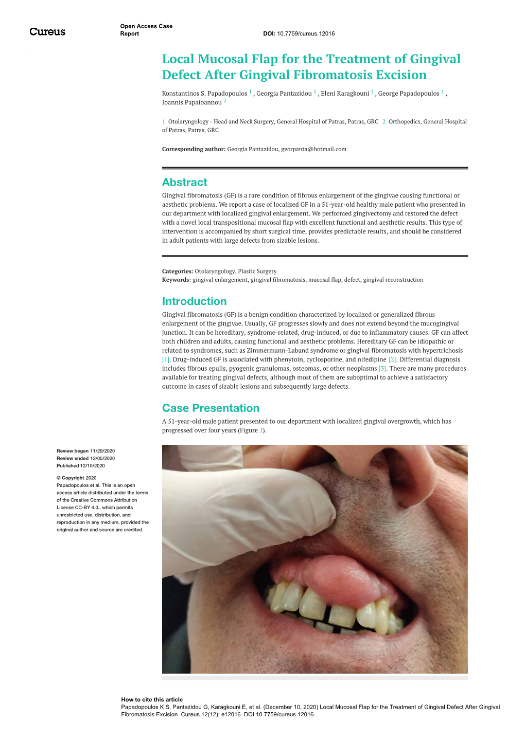 Local Mucosal Flap for the Treatment of Gingival Defect After Gingival Fibromatosis Excision