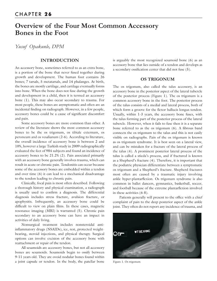 Overview of the Four Most Common Accessory Bones in the Foot