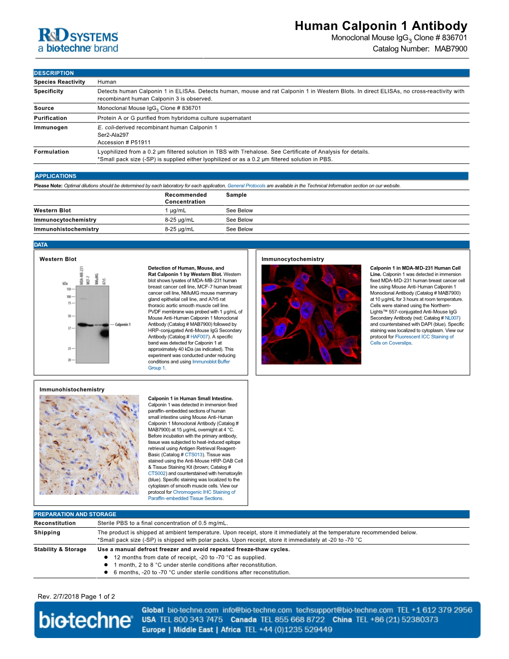 Human Calponin 1 Antibody