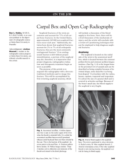 Carpal Box and Open Cup Radiography
